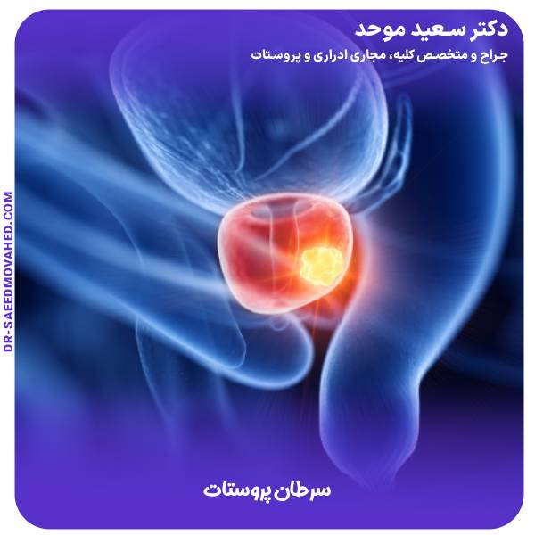 سرطان پروستات